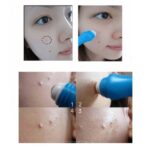 رول ضدجوش CLEAN YOUR SKIN اولاین - Image 5