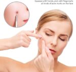 ابزار حذف جوش سر سیاه و اکنه مینیسو - Image 2