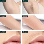 بند انداز برقی اولسنمارک مدل OMLS4117 - Image 7