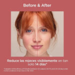 ضدآفتاب ضدقرمزی پوست حساس،ملتهب و قرمز ایزدین با SPF50 - Image 7