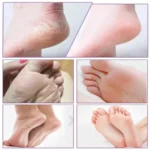 ماسک تغذیه و صاف کننده پوست پا مینیسو - Image 5