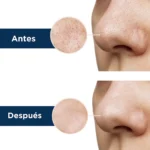ماسک و چسب پاکسازی بینی مینیسو - Image 9