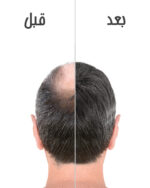 آمپول بیوتین بپانتن شرکت بایر المان - Image 5