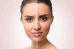 ژل شستشو سراوی حاوی 2% سالیسیلیک اسید | ضد جوش و درمان آکنه و جوش سر سیاه - Image 7