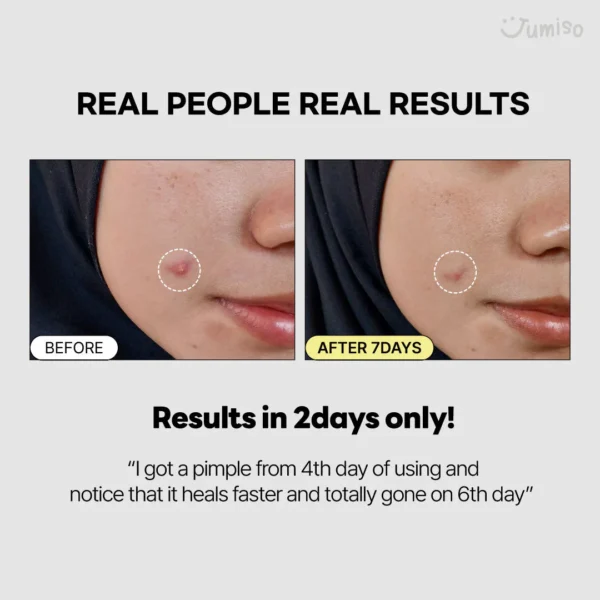 تونر اسنس موسین حلزون 95% و پپتید جومیسو | ابرسان و رفع جای جوش - Image 2
