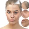 2-Myvitamins-Coconut-Collagen-Capsules-180-Tablets-Before-After