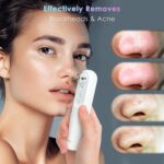 دستگاه پاکسازی صورت شیائومی inFace مدل CF-05E | جوش‌ سرسیاه، لایه‌بردار - Image 3