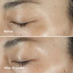 ست کرم اصلاح کننده چین و چروک پوست و دورچشم کلینیک - Image 4
