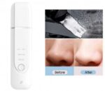 دستگاه پاکسازی صورت اولتراسونیک یونی شیائومی inFace مدل MS7100 - Image 3