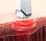 دستگاه لیفت و جوانسازی پوست شیائومی inFace مدل MS6000 - Image 5