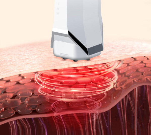 دستگاه لیفت و جوانسازی پوست شیائومی inFace مدل MS6000 - Image 5
