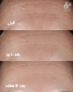 سرم ضد چروک اسمارت کلینیکال ریپر کلینیک SMART CLINICAL REPAIR از ایمابانو