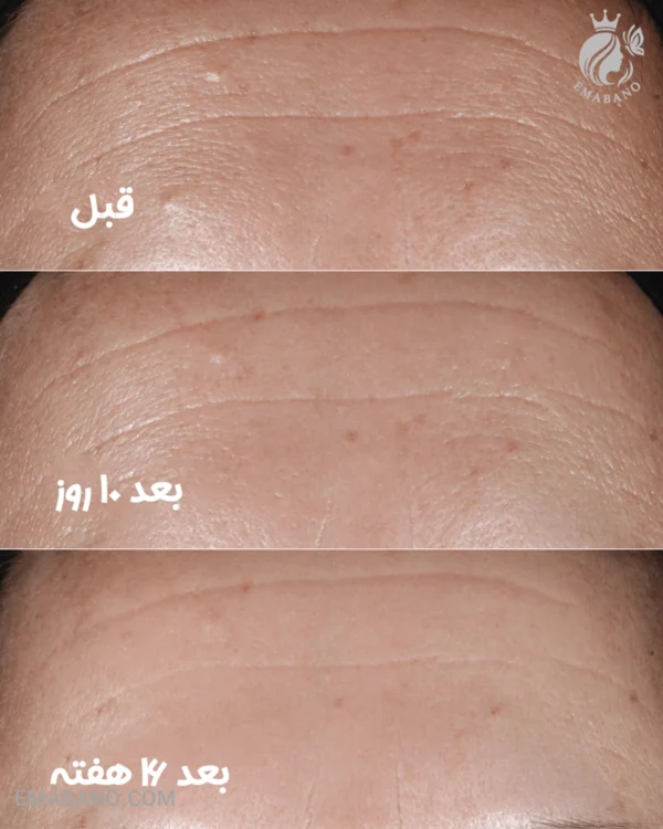 سرم ضد چروک اسمارت کلینیکال ریپر کلینیک SMART CLINICAL REPAIR از ایمابانو