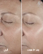 سرم ضد چروک اسمارت کلینیکال ریپر کلینیک SMART CLINICAL REPAIR از ایمابانو