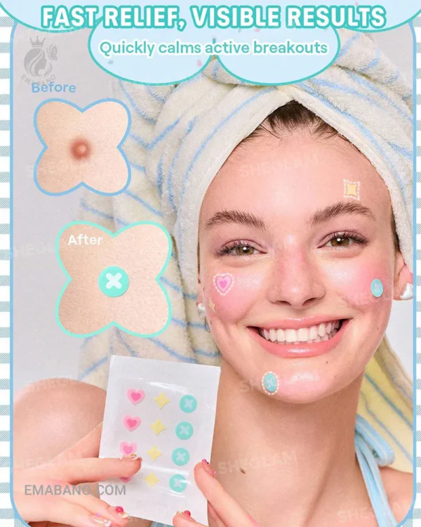 چسب ضدجوش رنگی شیگلم مدل Daydream Dots - Image 3