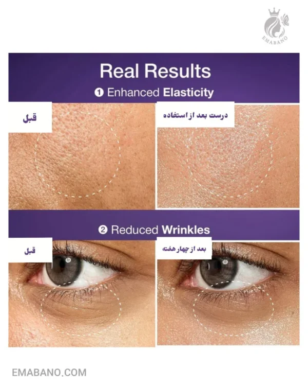 سرم اسنس لیفتینگ نامبوزین ضد چروک و سفت کننده - Image 4