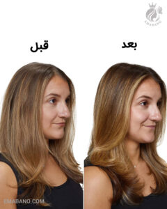 ماسک موی لورآل Blondifier براق‌کننده و ترمیم‌کننده موهای بلوند و رنگ‌شده